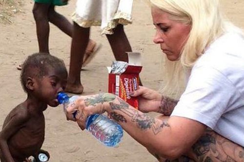 H απίστευτη μεταμόρφωση του παιδιού που οι γονείς του το άφησαν να πεθάνει γιατί το θεωρούσαν μάγο