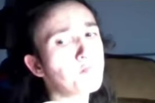 «Η Αλεξάνδρα παίζει μουσική με τα μάτια»: Το μοναδικό μουσικό όργανο στον κόσμο για τετραπληγικούς