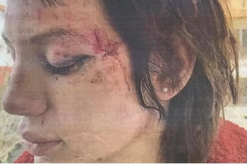 «Ήμουν πεσμένη στο δάπεδο και με χτυπούσαν αλύπητα στο κεφάλι με τα παπούτσια τους»