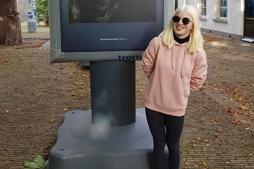 Γεννήθηκε με αλμπινισμό, εγκαταλείφθηκε όταν ήταν μωρό. Σήμερα είναι μοντέλο κορυφαίων brands