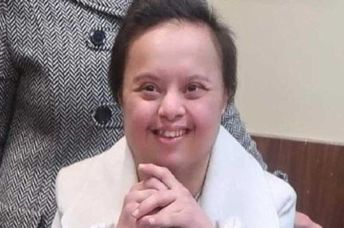 Η δύναμη της θέλησης: Η Μαρία Νίτσα θα γίνει η πρώτη νηπιαγωγός με σύνδρομο Down στην Ελλάδα