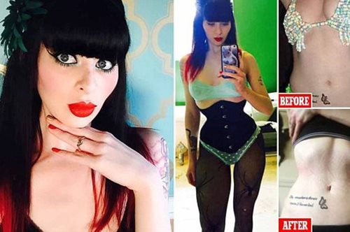 Φοράει 22 ώρες την ημέρα έναν στενό κoρσέ για να αποκτήσει μέση-κλεψύδρα