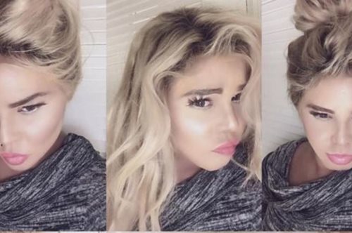 Η σοκαριστική αλλαγή που έγινε viral. Δε φαντάζεσαι ποια είναι η τραγουδίστρια της φωτογραφίας