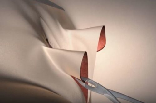 Για πρώτη φορά ένα βίντεο δείχνει βήμα-βήμα την αλλαγή φύλου ενός άνδρα σε γυναίκα