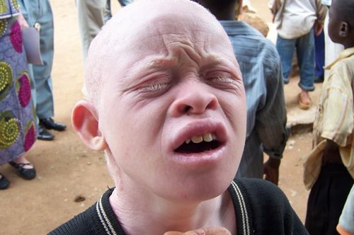 9χρονος αλμπίνος θανατώθηκε και η μητέρα κλήθηκε να αναγνωρίσει το κομμένο κεφάλι του