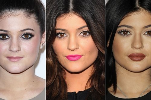 Οι 6 φωτογραφίες που θα ήθελε να κάψει η Kylie Jenner. Έτσι ήταν πριν τις πλαστικές επεμβάσεις