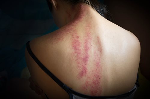 «Πώς κατάφερα να ξεφύγω από το trafficking». Μια γυναίκα αφηγείται