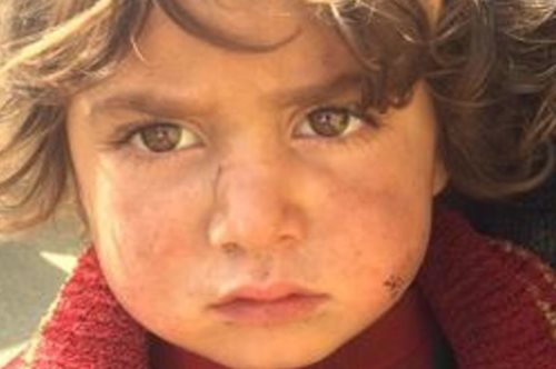 «Πώς είναι να παντρεύεσαι σε ηλικία 7 ετών;». Μια 37χρονη Αφγανή αφηγείται την ιστορία της