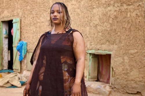 Αναγκαστική σίτιση για να βρουν σύζυγο: 16.000 θερμίδες την ημέρα για τα κορίτσια στη  Μαυριτανία 