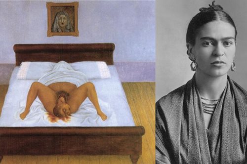 Η Φρίντα Κάλο ήταν 