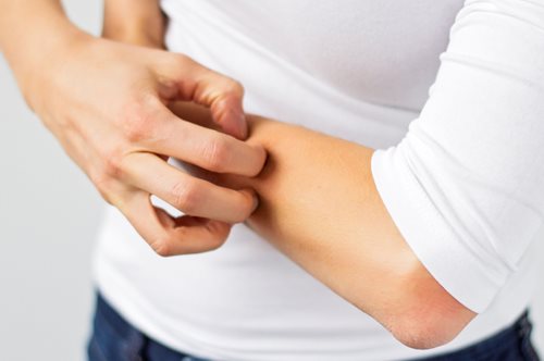 Μάθε να ξεχωρίζεις τα τσιμπήματα των εντόμων από τα εξανθήματα