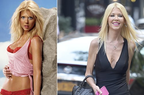 Η ανορεξία σαρώνει στο Χόλιγουντ: Μεταμόρφωση - σοκ για πανέμορφη ηθοποιό