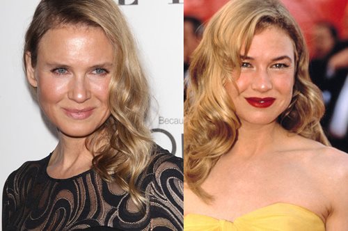 Η Ρενέ Ζελβέγκερ εξηγεί γιατί το πρόσωπο της είναι 