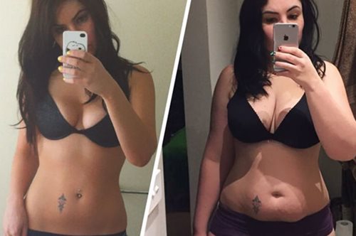 Μια μαμά ανέβασε φωτογραφίες με το σώμα της πριν και μετά τον τοκετό, σπάζοντας όλα τα ταμπού