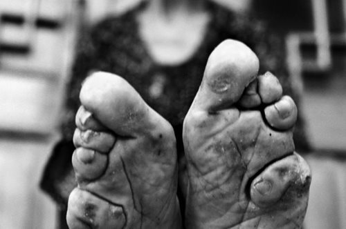 Πώς οι τελευταίες Κινέζες με τα πόδια του λωτού κάνουν το ωραίο εντελώς υποκειμενικό