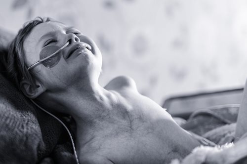 «Αυτό είναι το πραγματικό πρόσωπο του καρκίνου» Πατέρας μοιράζεται τη σπαρακτική εικόνα του παιδιού