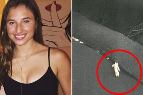 Πελάτισσα των ZARA βρήκε ψόφιο ποντίκι στο στρίφωμα του φορέματός της