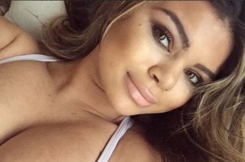 Ιnstagrammer ανεβάζει φωτογραφίες της επειδή έχει βάλει κιλά και νιώθει ωραία με τις ραγάδες της 