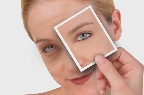 Οι τροφές που μειώνουν αισθητά τις σακούλες στα μάτια