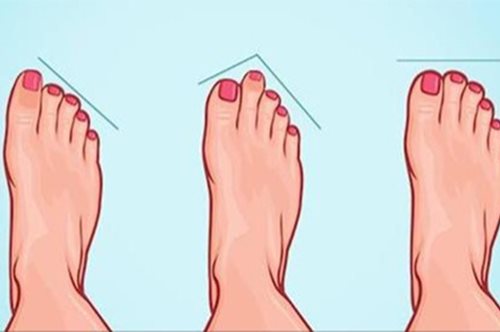 Τι λέει το σχήμα του ποδιού σας για την προσωπικότητά σας; 