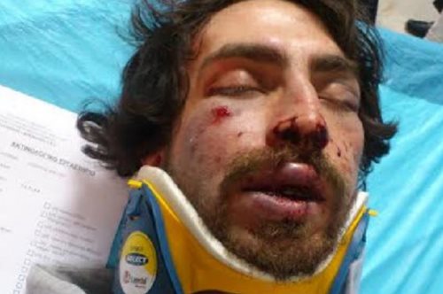 Τι είπε μέσα από το νοσοκομείο ο φοιτητής που ξυλοκοπήθηκε άγρια