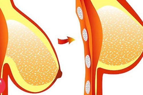 Οι διαφορές που θα δεις στο σώμα σου εάν αρχίσεις να γυμνάζεσαι τώρα. Η βαρύτητα καταρρίπτεται  