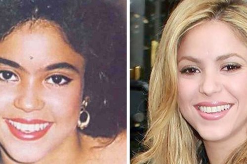 Τα ασχημόπαπα που έγιναν κύκνοι. Δέκα διάσημοι που άλλαξαν «δέρμα» μέσα στα χρόνια 