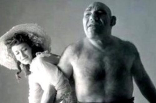 Ο πραγματικός Σρεκ: Η ιστορία του αγοριού που παραμορφώθηκε εξαιτίας μιας σπάνιας νόσου