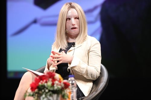 «Έχω ένα ανοιχτό τραύμα που με ταλαιπωρεί αρκετά κάνω υπομονή. Τhat’s my life right now»