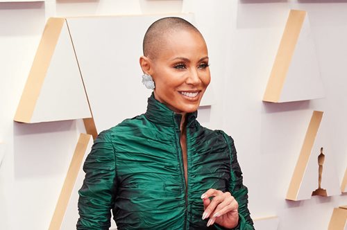 Τι ακριβώς είναι η αλωπεκία; Όσα πρέπει να ξέρεις για το αυτοάνοσο