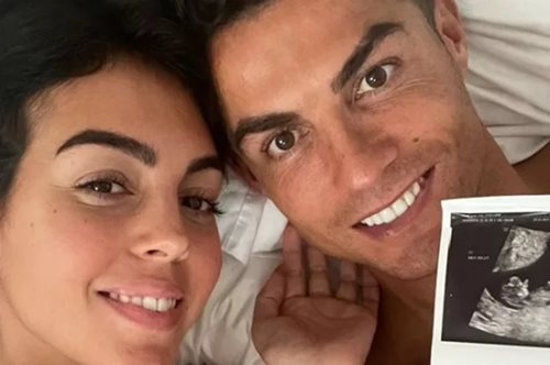 Ρονάλντο-Ροντρίγκεζ: Πέθανε το ένα από τα δίδυμα μωρά τους