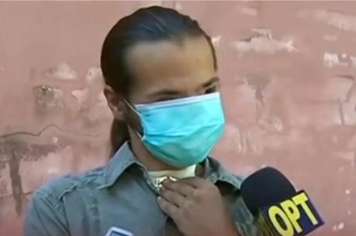 Ποιος κάνει ακόμα bullying σε ανθρώπους με παραμόρφωση στο πρόσωπο;