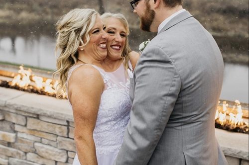 ΗΠΑ: Σιαμαίες αδερφές παντρεύονται και σκέφτονται να γίνουν μητέρες