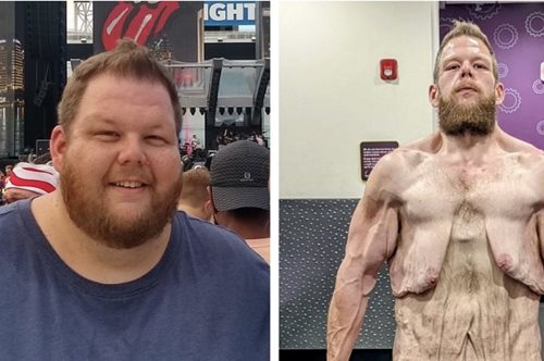 O άντρας που έχασε 152 κιλά και τώρα διχάζει το κοινό