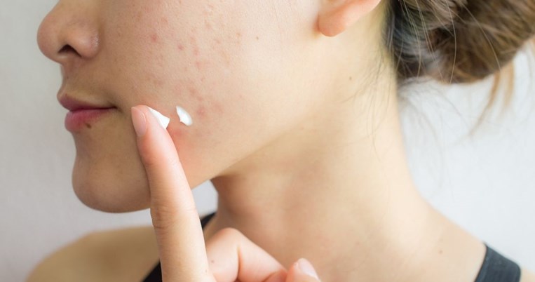 Σαλικυλικό Οξύ: όλα όσα πρέπει να ξέρεις για το δραστικό συστατικό