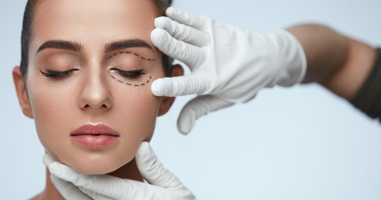 blepharoplasty
