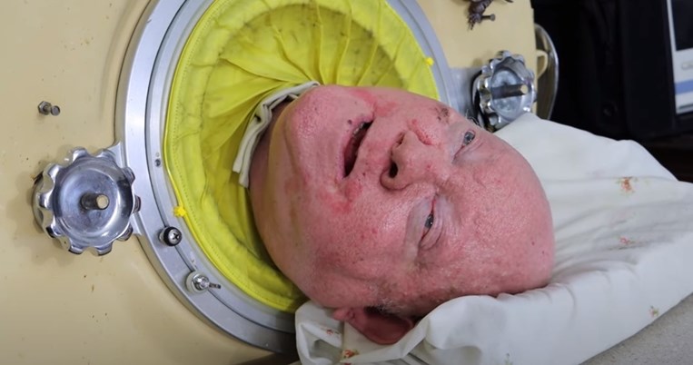 ηλικιωμενος_σωληνα