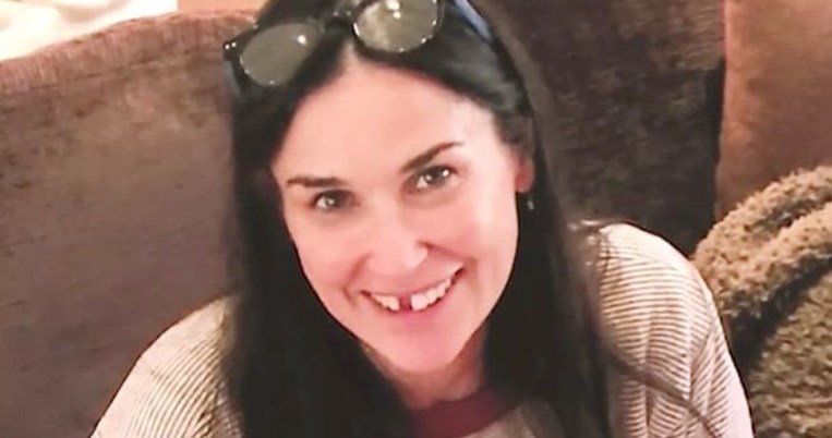 Έπεσαν τα δύο μπροστινά δόντια της Ντέμι Μουρ 