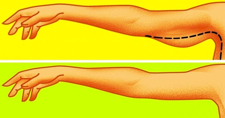 13 ασκήσεις του 5άλεπτου που θα μεταμορφώσουν τα χαλαρά μπράτσα σε σφριγηλά
