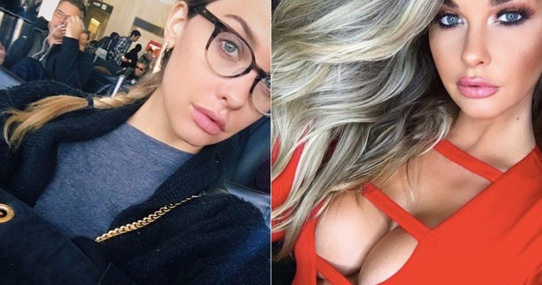 Μοντέλο βρήκε έναν έξυπνο τρόπο να τιμωρεί άνδρες που της στέλνουν φωτογραφίες με τα μόριά τους