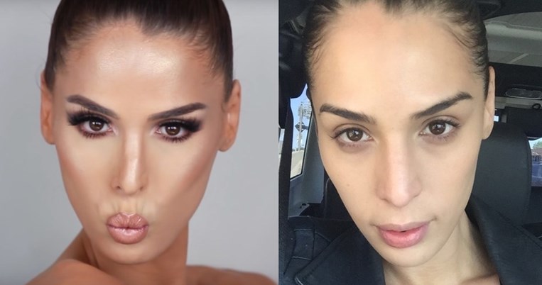 Άνθρωποι δοκιμάζουν την 5λεπτη επέμβαση αντί για πλαστική στη μύτη και ξεσπούν σε δάκρυα χαράς 