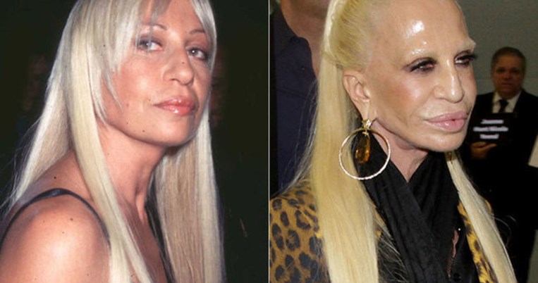 Τι πήγε στραβά; Οι 15 πιο αποτυχημένες πλαστικές των celebrities