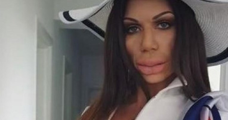 Αυτός είναι ο λόγος που η Κατερίνα Στικούδη παραμορφώθηκε από τα μπότοξ