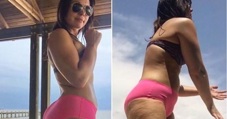 Mία fitness blogger δείχνει τα πόδια της στο Instagram έτσι όπως τα κακοφωτίζει ο ήλιος