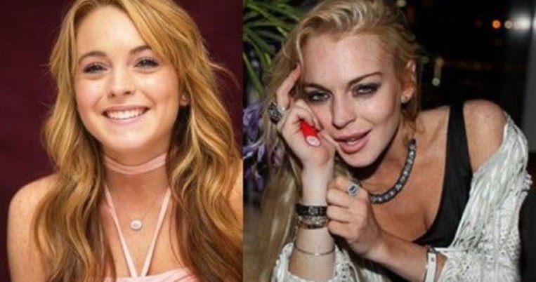 14 διάσημοι πριν και μετά τον εθισμό στα ναρκωτικά