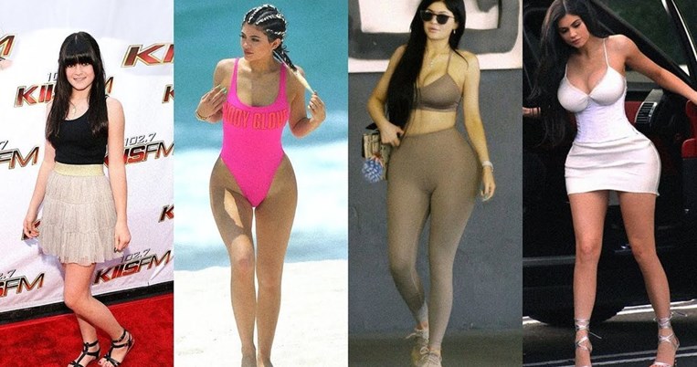 Προσθέσεις κι αφαιρέσεις επιθεμάτων με φόντο δισεκατομμύρια: Η Κάιλι Τζένερ από ενός έως 20 ετών