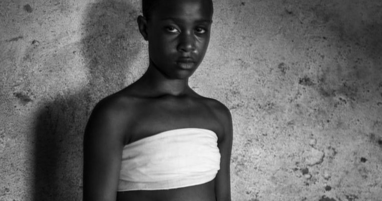«Μανούλα καίει».  Δεκάδες μικρά κορίτσια στην Βρετανία υποβάλλονται σε σιδέρωμα στήθους