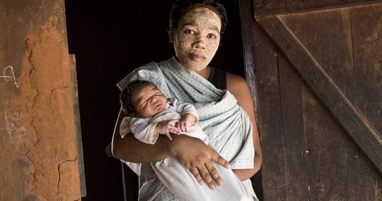 Άλλοτε με μαντζούνια, άλλοτε με σκοινιά. Πώς γεννιούνται τα παιδιά σε διαφορετικές χώρες του κόσμου