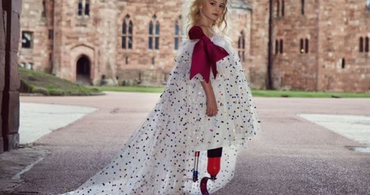 Παγκόσμιος θαυμασμός: 9χρονη με διπλό ακρωτηριασμό στην εβδομάδα μόδας για παιδιά 