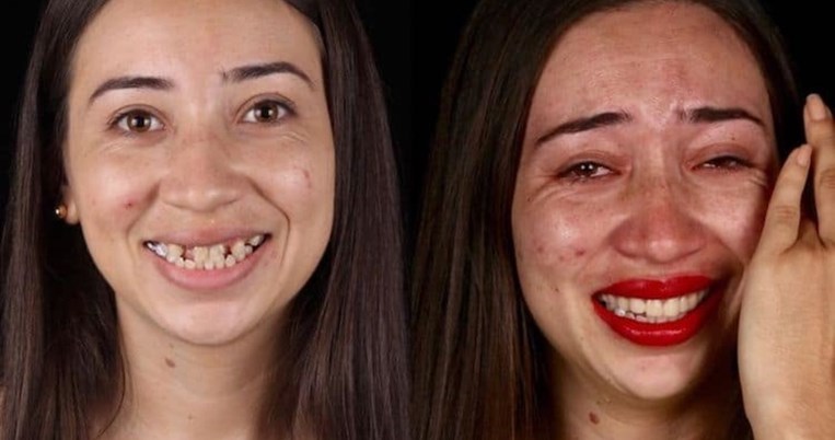 Ο οδοντίατρος που έχει φτιάξει δωρεάν τα δόντια 1.500 απόρων. Χαρίζει ομορφιά, υγεία, αυτοπεποίθηση